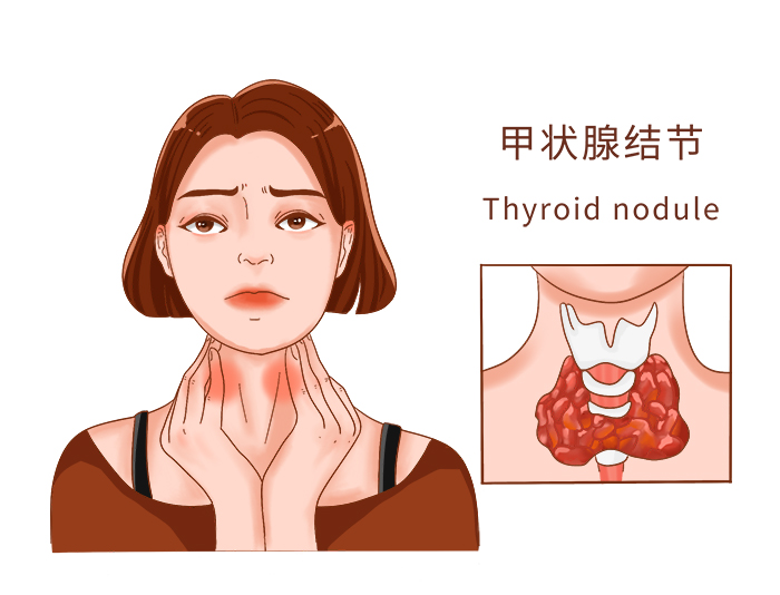 14医疗系列常见医疗疾病人物图例甲状腺结节.jpg