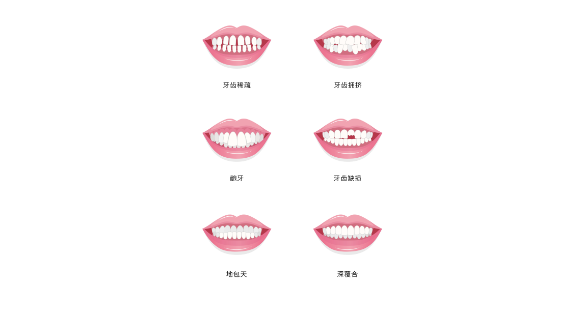 有你吗？这四类人牙齿矫正可能很惊艳！