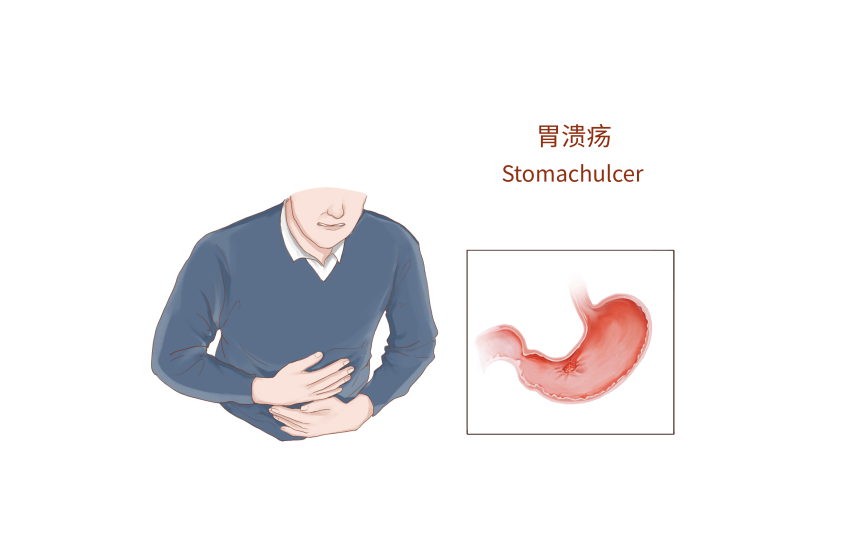 肠胃不好饮食如何调理？快试试这些养胃的食物