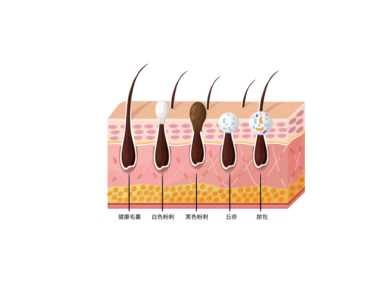 c4171a91a04f856052f48341e45b1d2.png